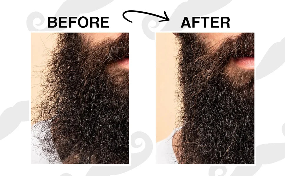 Kit Completo per la Cura della Barba 5 in 1 – Olio e Balsamo Modellante